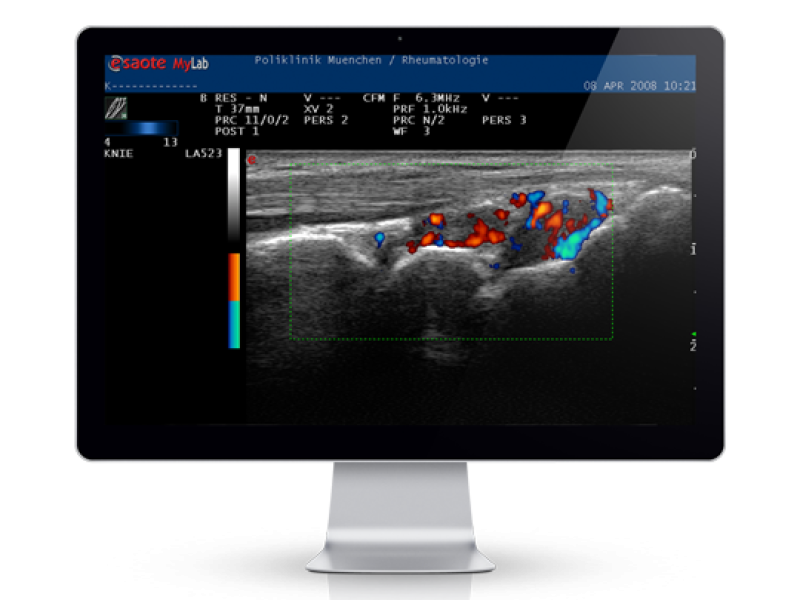 ULTRASCHALLDIAGNOSTIK